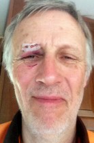 Pas trop beau p'tits yeux....